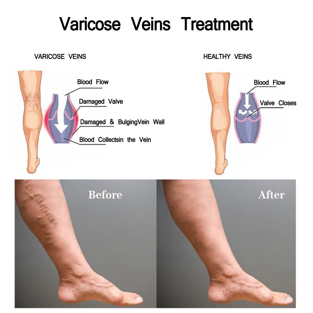 Vein Relief Nursing Cream