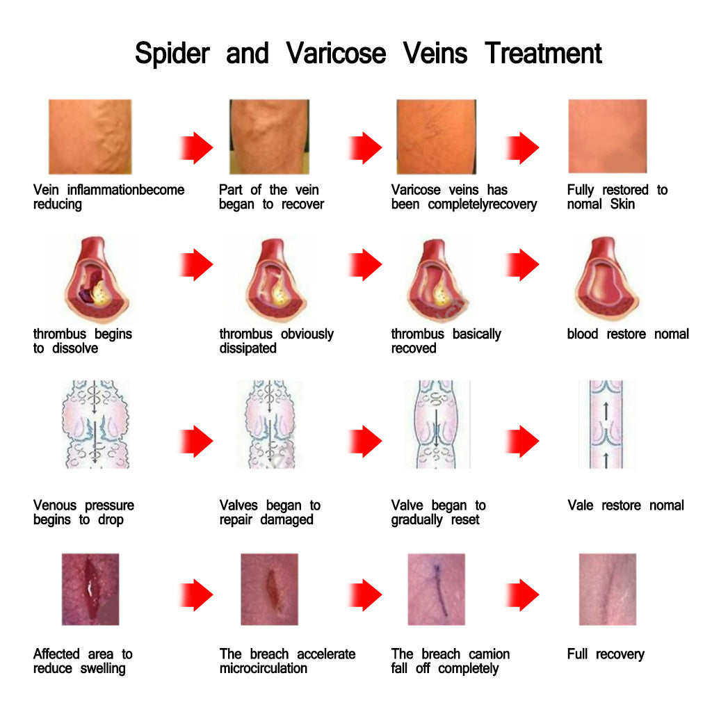 Vein Relief Nursing Cream