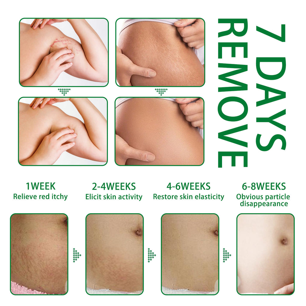 Postpartum Firming Skin Spray
